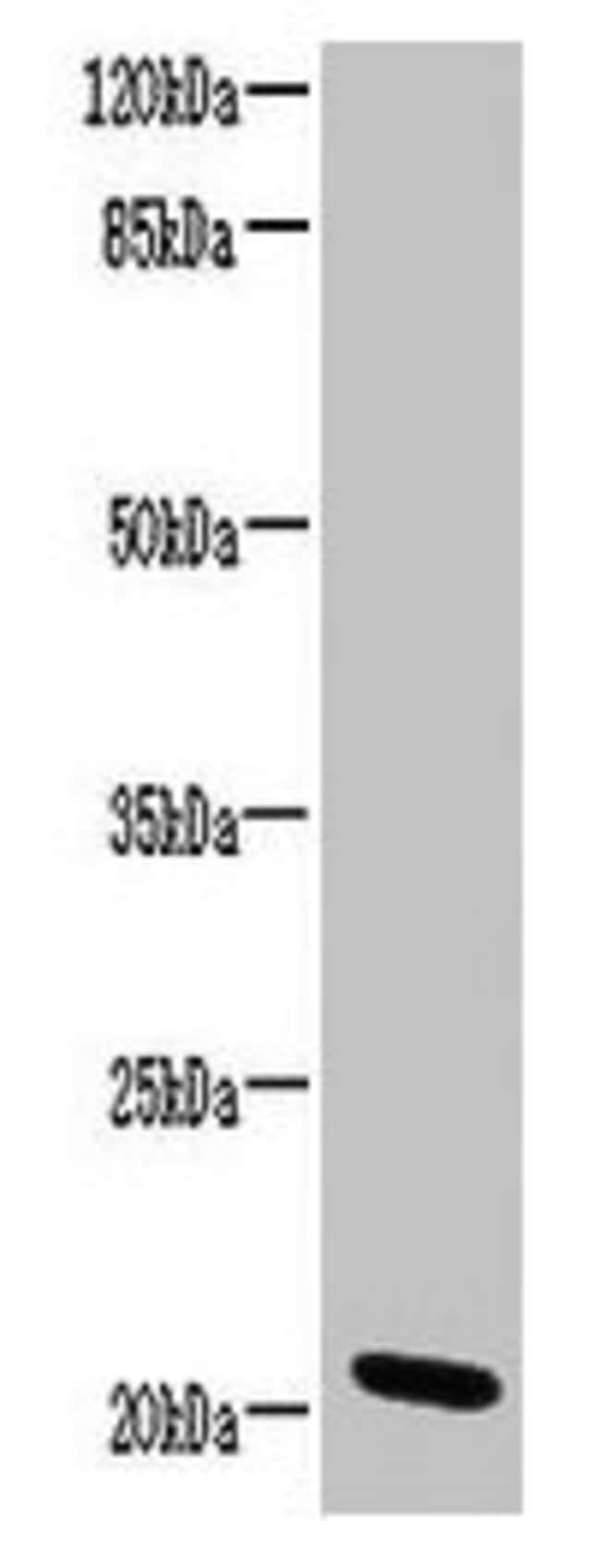 100UG C15ORF57 ANTIBODY 100 ug