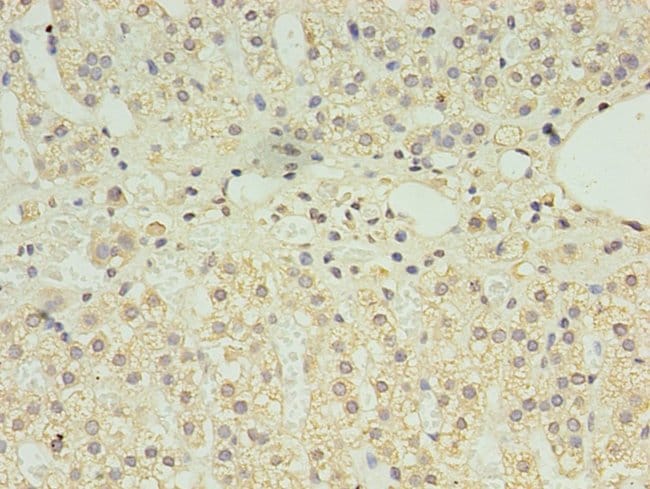 100UG CLPB ANTIBODY 100 ug