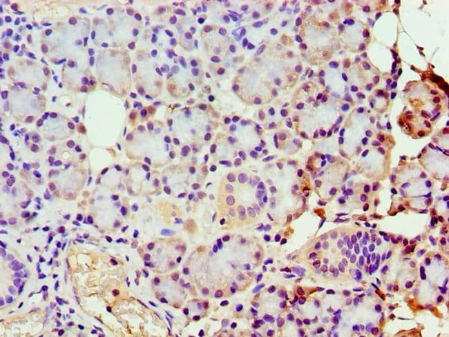 100UL GBA3 ANTIBODY 100 ul