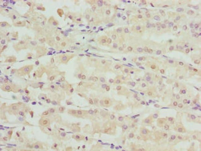 100UG RIBC2 ANTIBODY 100 ug