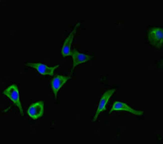 100UG DHX33 ANTIBODY 100 ug
