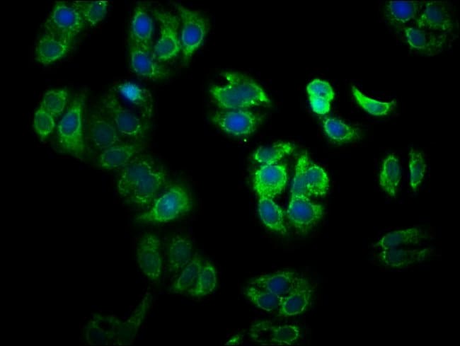 100UG YY1AP1 ANTIBODY 100 ug