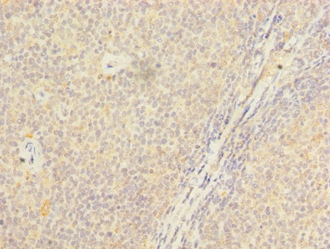 100UG PSTPIP2 ANTIBODY 100 ug