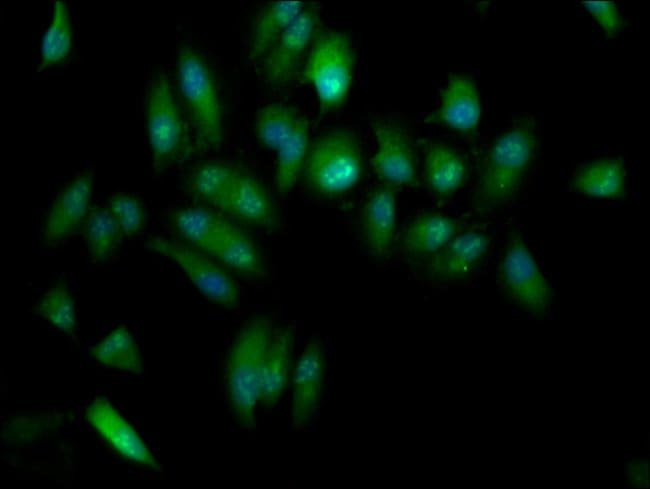 100UG ELP3 ANTIBODY 100 ug