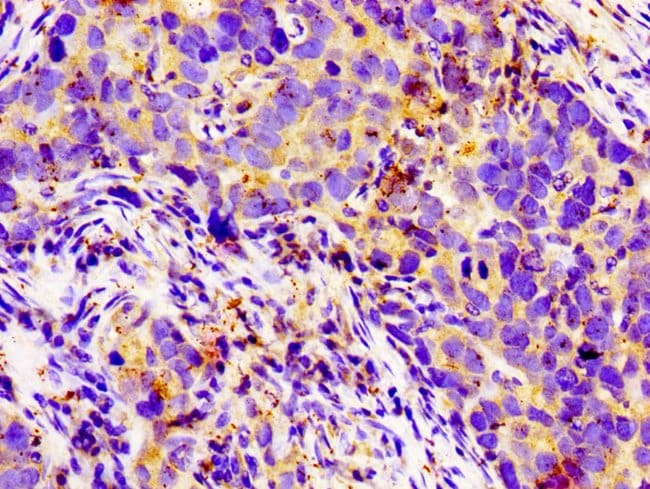 100UG LGR6 ANTIBODY 100 ug