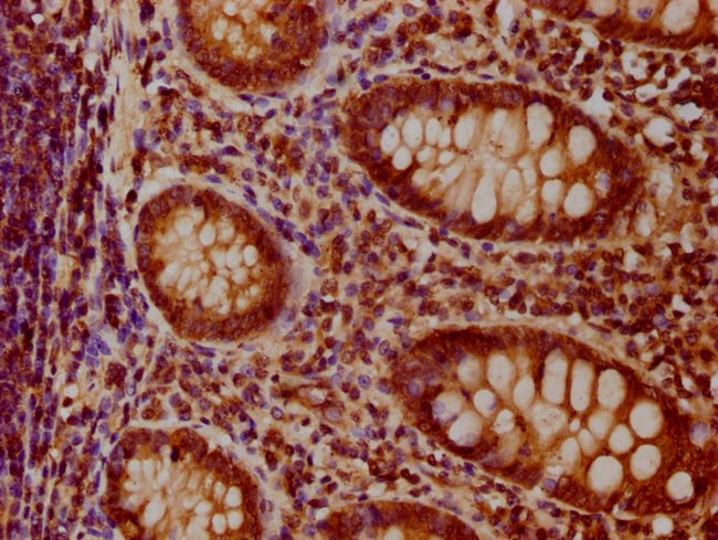 100UG C3ORF1 ANTIBODY 100 ug