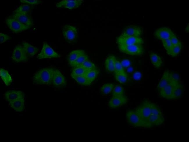 100UG TMEM16B ANTIBODY 100 ug