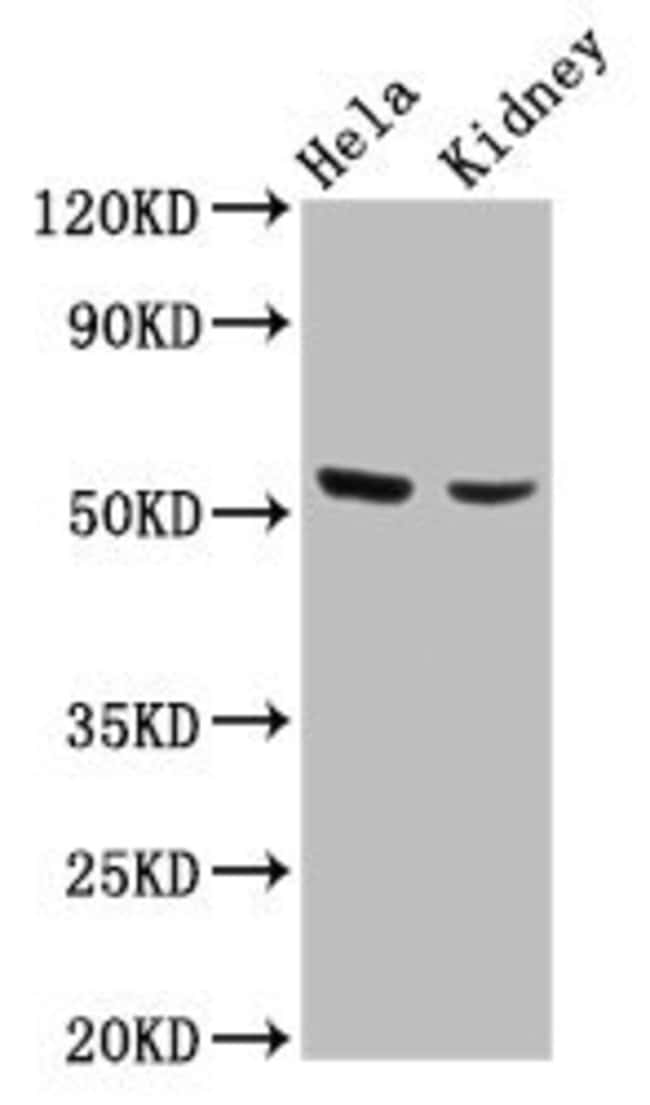 100UG POLK ANTIBODY 100 ug