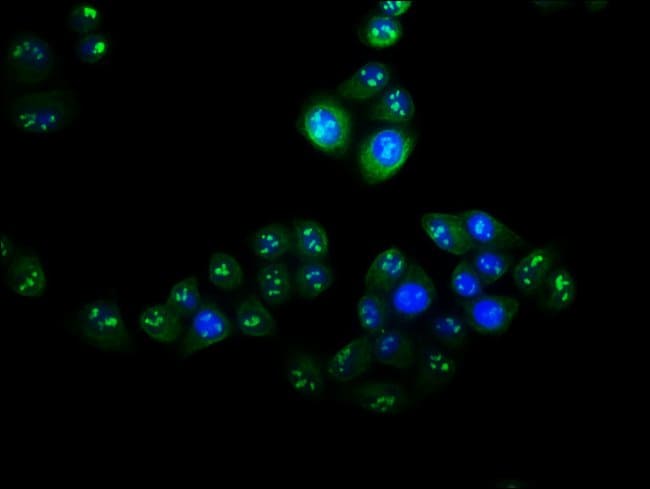 100UG VPS25 ANTIBODY 100 ug