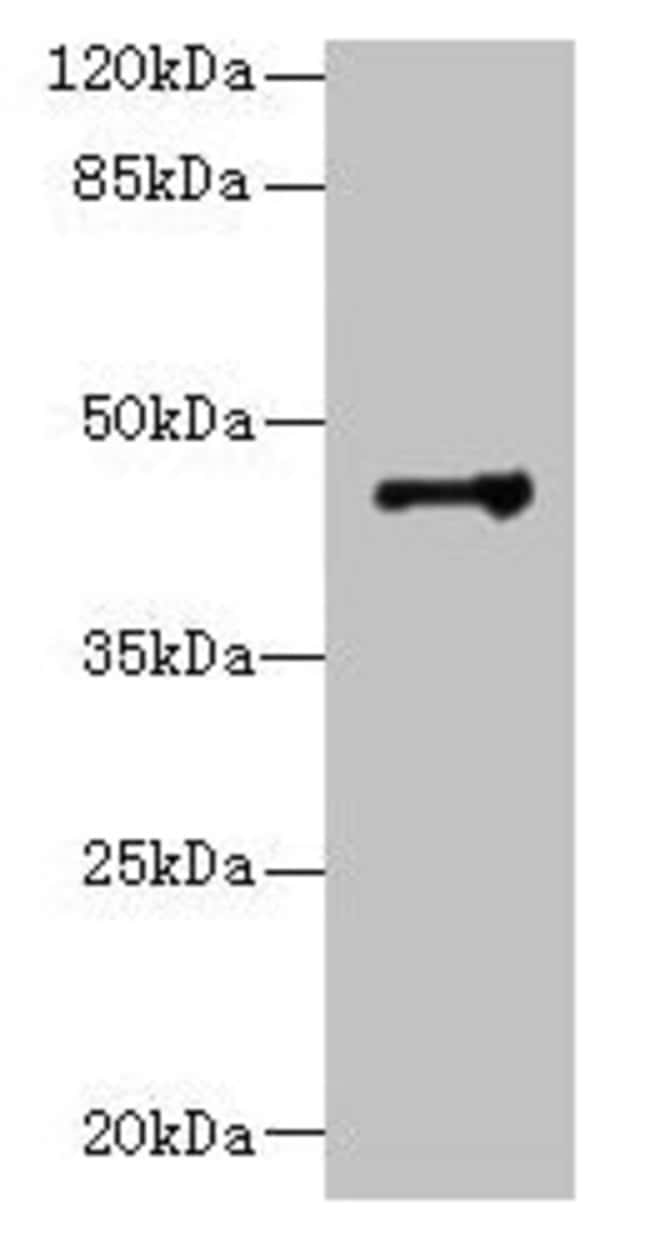 100UG DSCC1 ANTIBODY 100 ug
