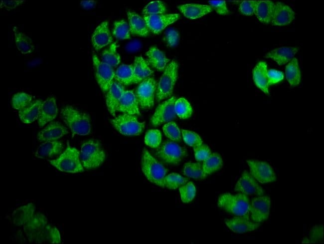 100UG GPR174 ANTIBODY 100 ug