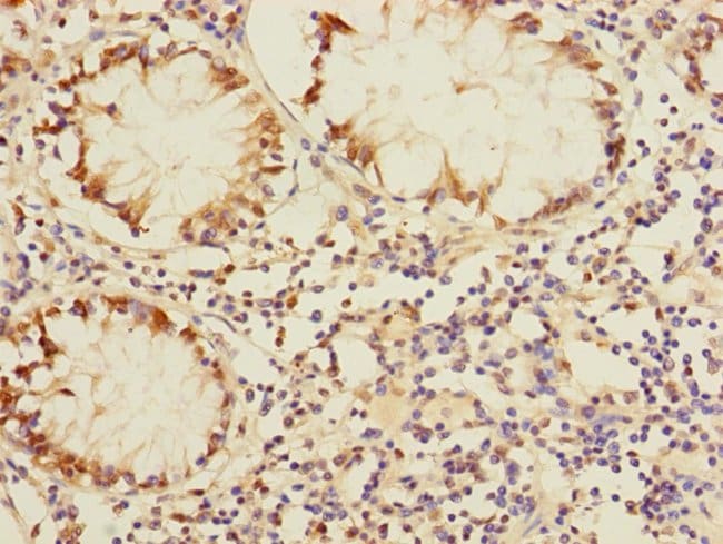100UL DUSP16 ANTIBODY 100 ul