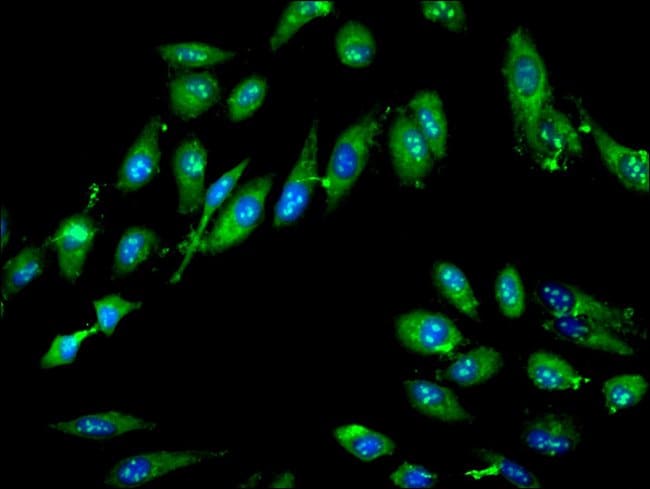 100UG GTPBP4 ANTIBODY 100 ug