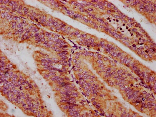 100UG CXORF36 ANTIBODY 100 ug
