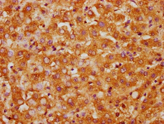 100UG CK1 GAMMA-1 ANTIBODY 100 ug