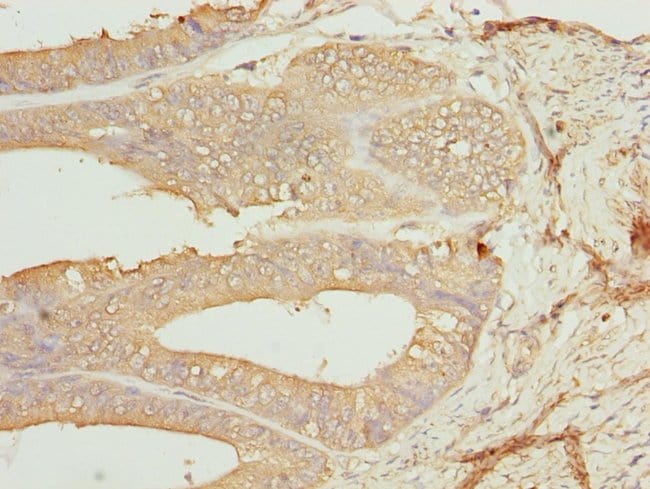 100UL CK1 GAMMA-1 ANTIBODY 100 ul