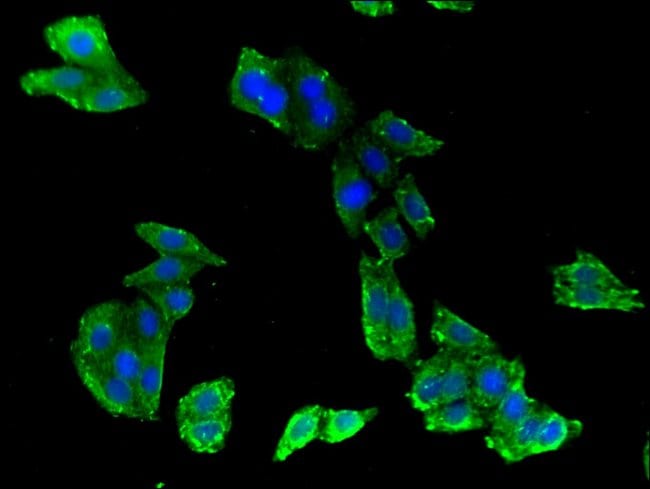100UG ABCB9 ANTIBODY 100 ug
