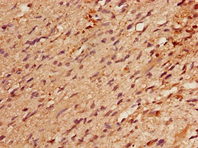 100UG RBM22 ANTIBODY 100 ug