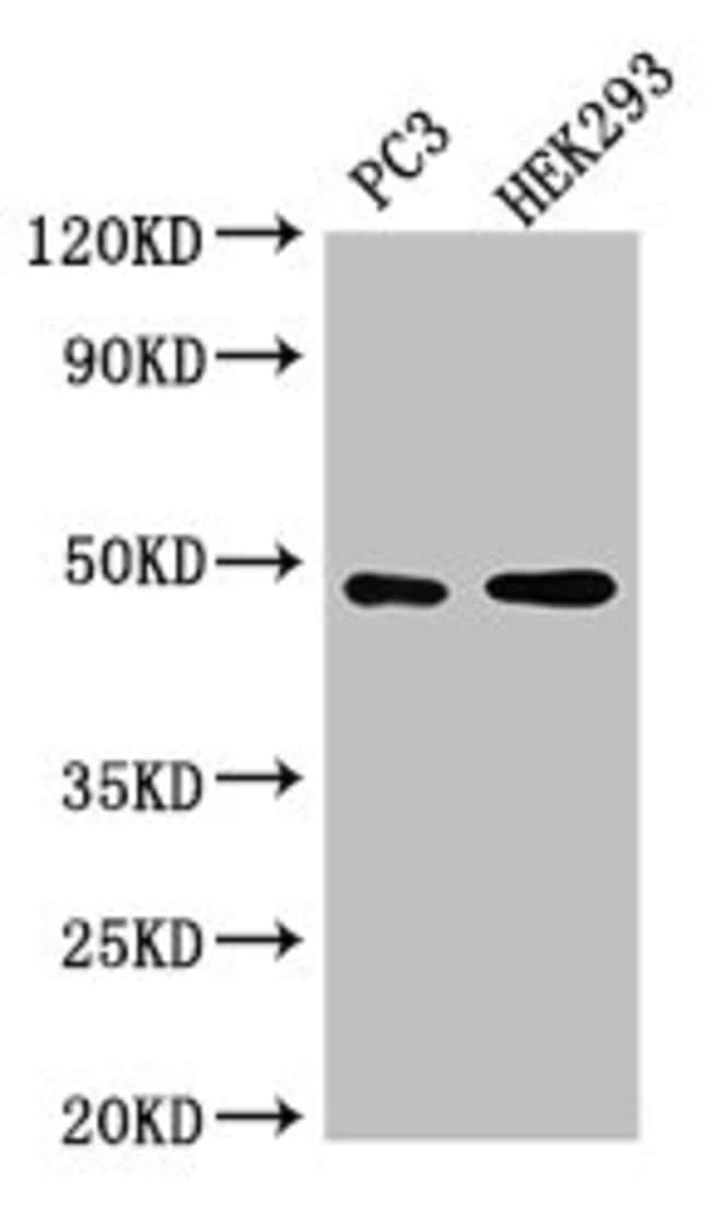 100UG ACTR10 ANTIBODY 100 ug