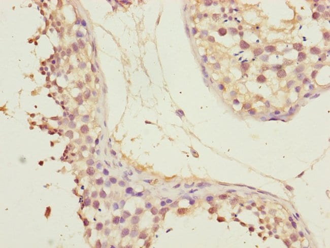 100UL CEP72 ANTIBODY 100 ul