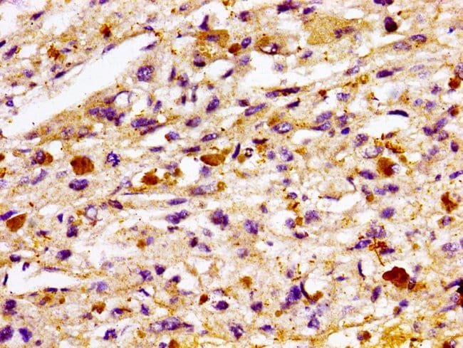100UG TBC1D14 ANTIBODY 100 ug