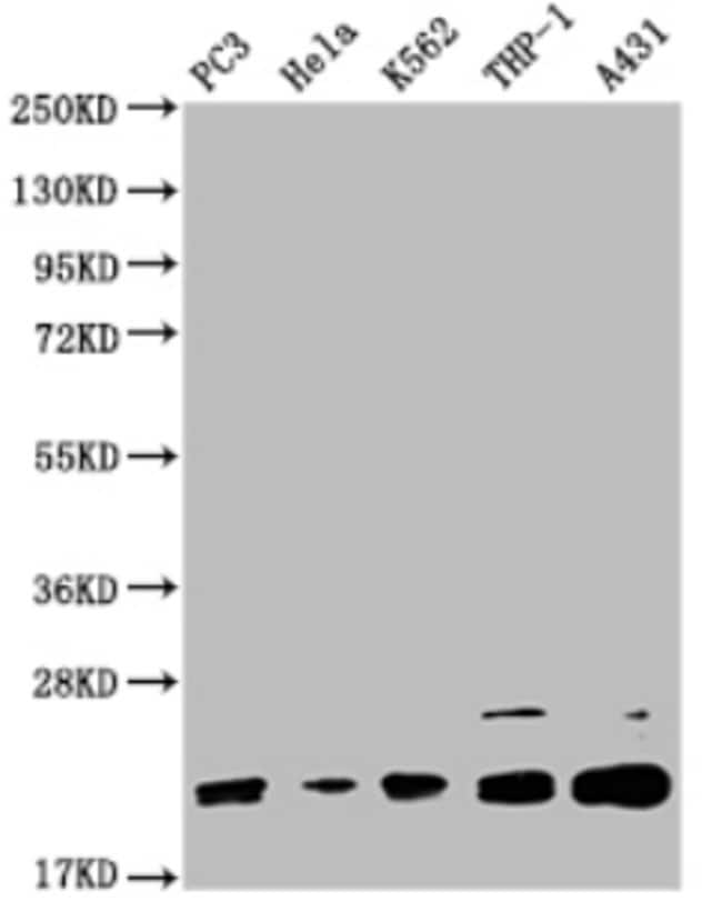 100UG VPS29 ANTIBODY 100 ug