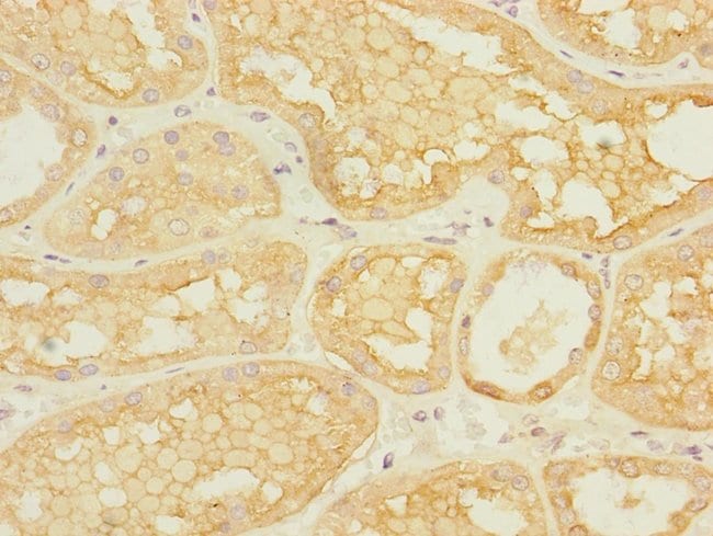 100UL ASIC3 ANTIBODY 100 ul