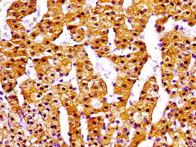 100UG NPC1 ANTIBODY 100 ug
