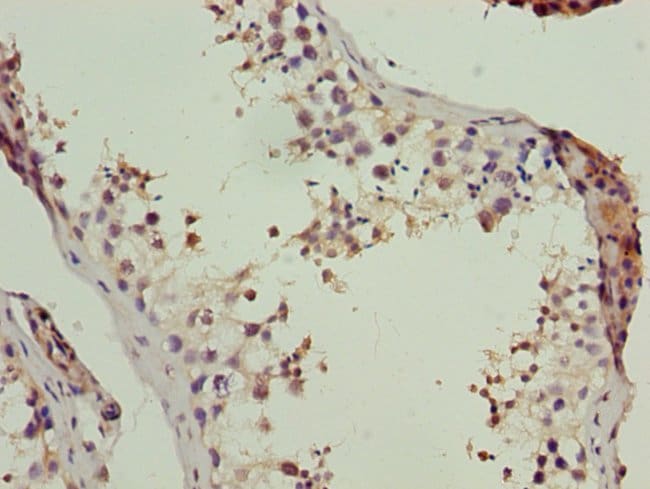 100UG LSM7 ANTIBODY 100 ug