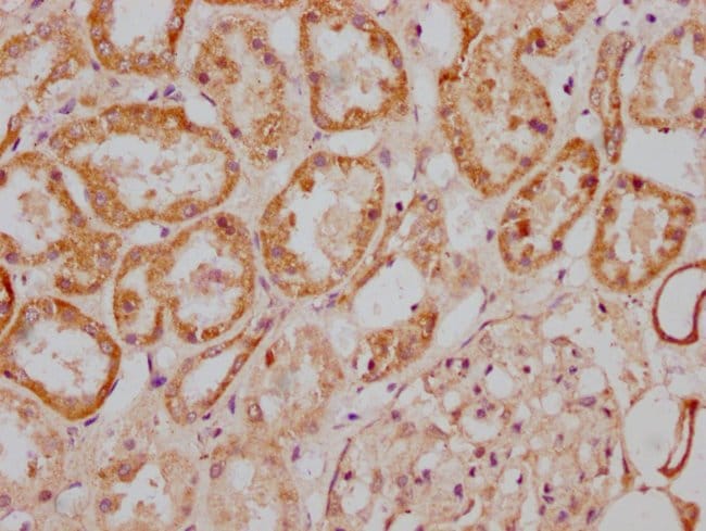 100UG MGAT4B ANTIBODY 100 ug