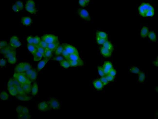 100UG NDRG4 ANTIBODY 100 ug