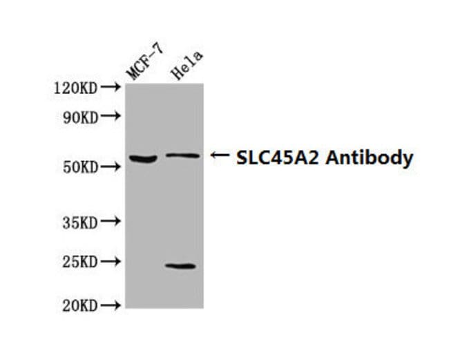 100UG SLC45A2 ANTIBODY 100 ug
