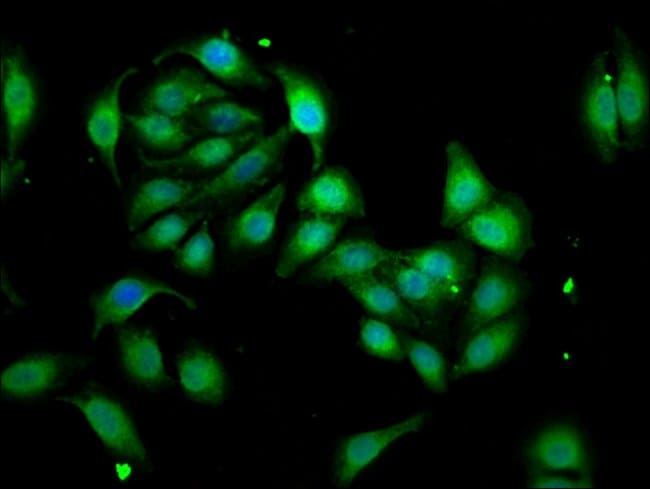 100UG WASF3 ANTIBODY 100 ug