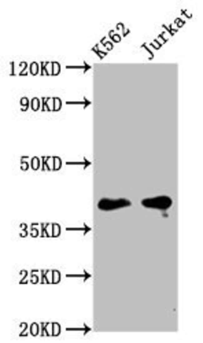 100UG PURG ANTIBODY 100 ug
