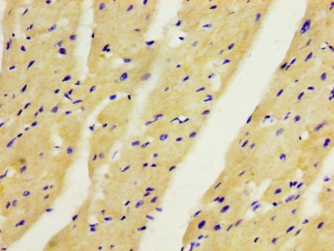100UG ANGPTL2 ANTIBODY 100 ug