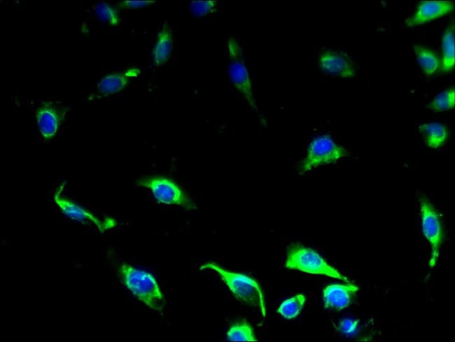 100UG GPR34 ANTIBODY 100 ug