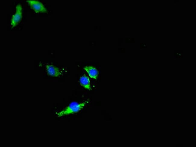 100UG DNMT3L ANTIBODY 100 ug