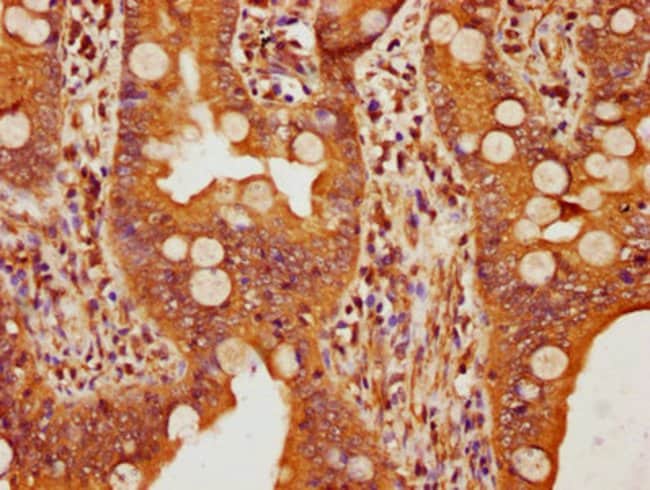 100UL FBXW11 ANTIBODY 100 ul