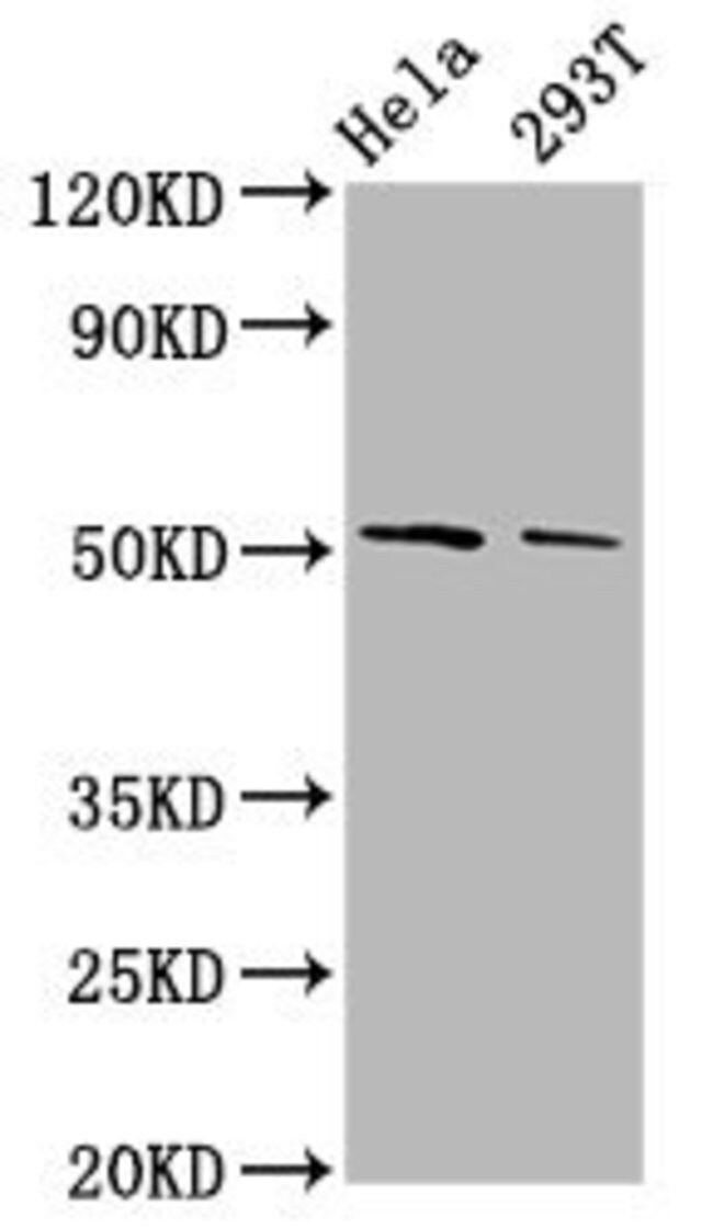 100UG PLAGL2 ANTIBODY 100 ug