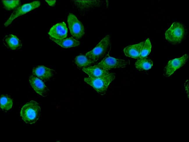100UG BAIAP2 ANTIBODY 100 ug