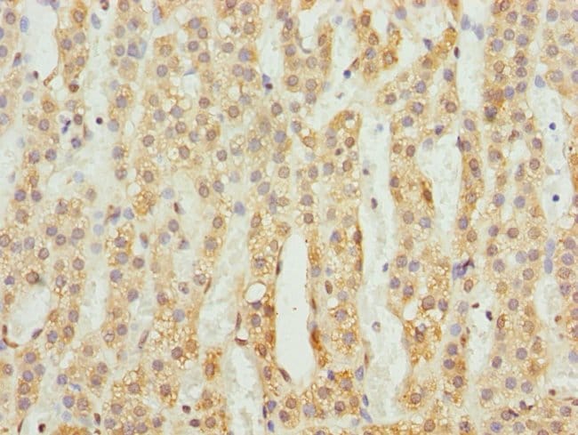 100UL ACSL6 ANTIBODY 100 ul