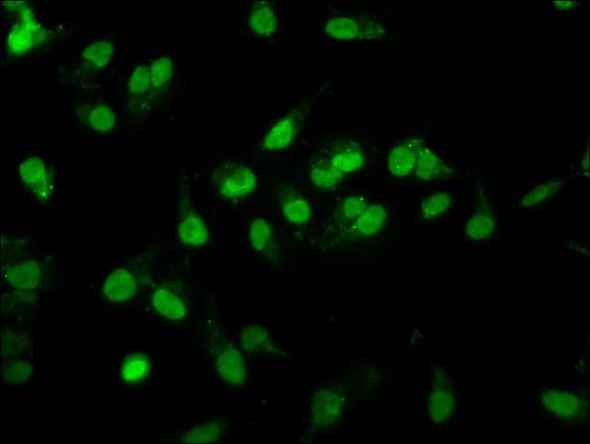 100UG RALY ANTIBODY 100 ug