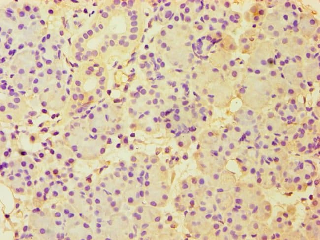 100UL CBLC ANTIBODY 100 ul