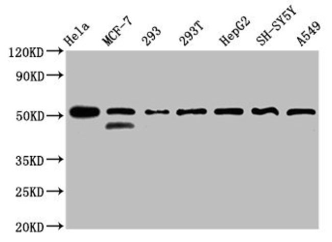 100UG PLAGL1 ANTIBODY 100 ug