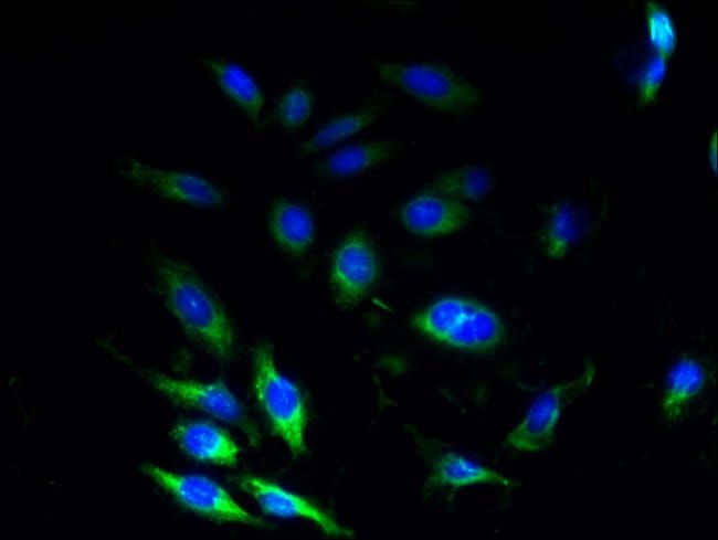 100UG SSR3 ANTIBODY 100 ug