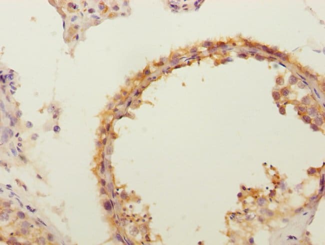 100UL FLVCR2 ANTIBODY 100 ul