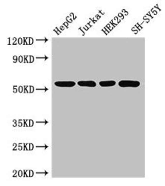 100UG DYNACTIN 4 ANTIBODY 100 ug