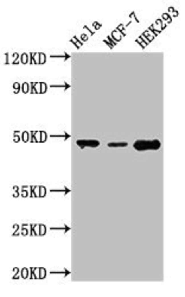 100UG PACSIN3 ANTIBODY 100 ug