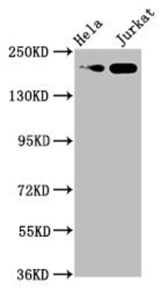 100UL MYH2 ANTIBODY 100 ul