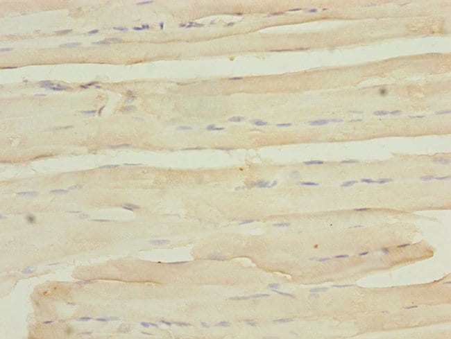 100UL MYO5B ANTIBODY 100 ul